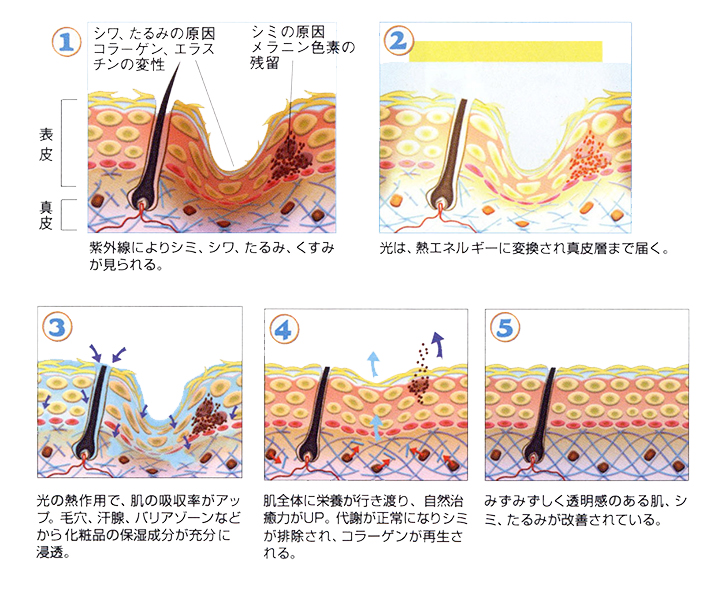 当院での美肌治療